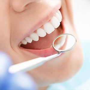 Dental Implants Dentist in Mason